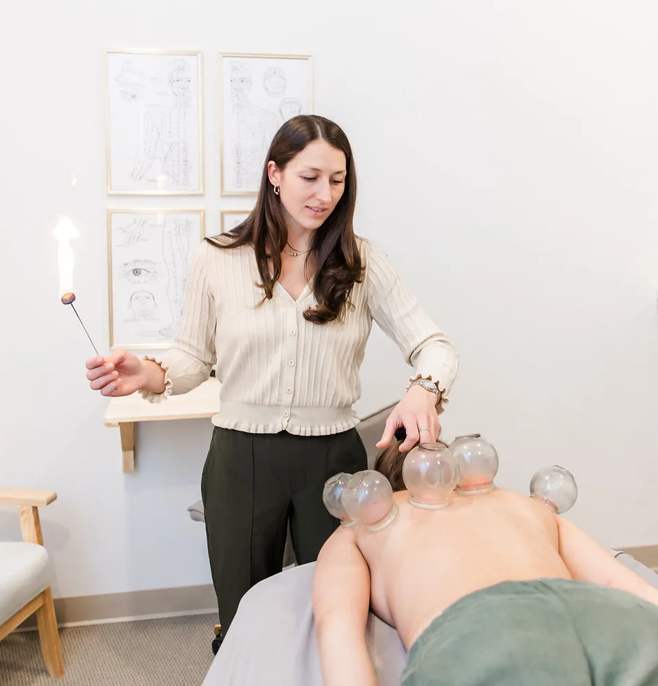 What is Cupping?