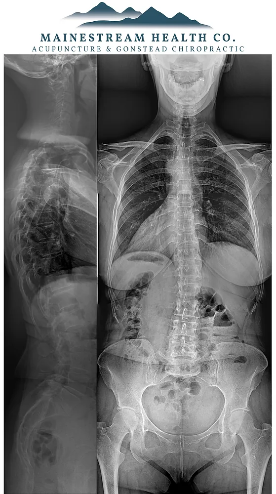 A Gray, Maine Chiropractor's Guide (Part 2): Things to look out for & what to expect