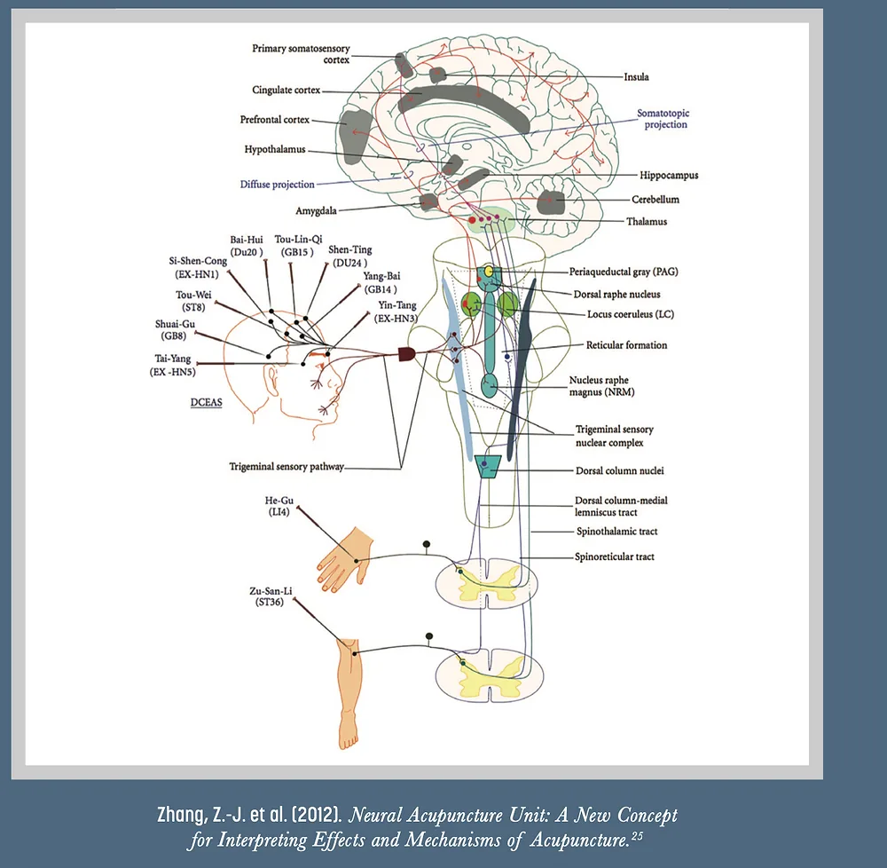 Acupuncture: A Natural Path for Relieving Chronic Pain